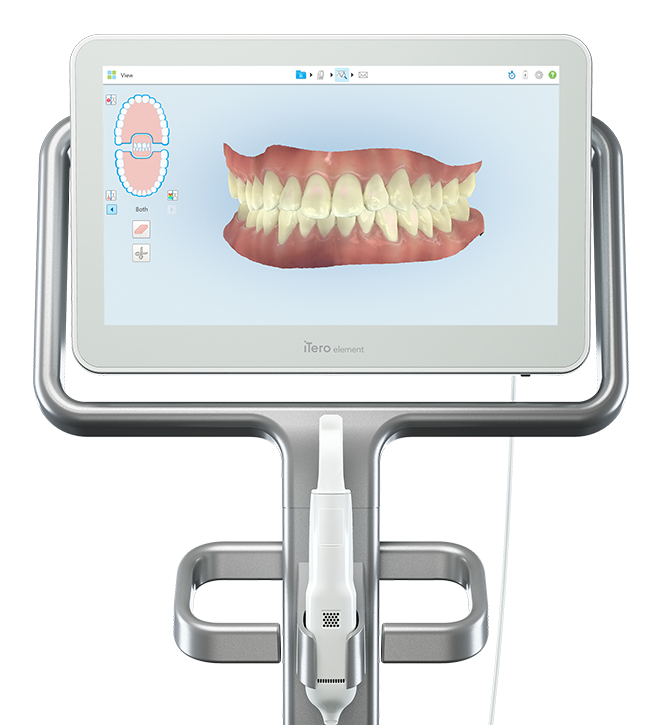 iTero　element Itero Element Scanner Intraoral | MercadoLivre